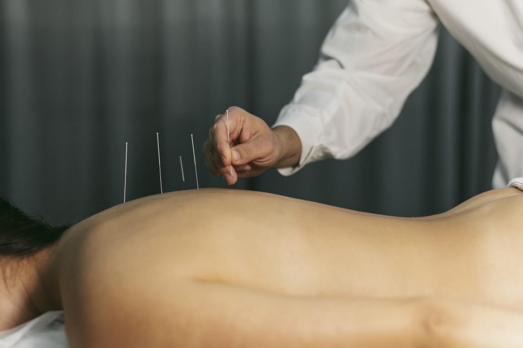 Acupuncturist in waalwijk